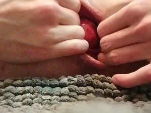 Gay Prolasso Anale - Porno @ CuloNudo.com
